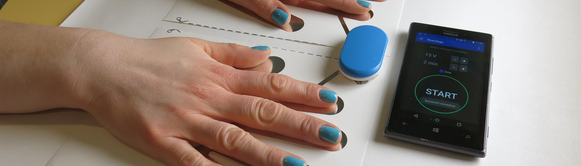 , VTT is bringing out a small and consumer-friendly treatment device for excessive sweating