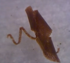 , New remote-controlled microrobots for medical operations