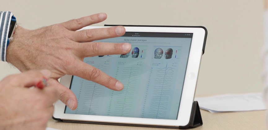 , Epilog Technology Improves Diagnosis of Epilepsy using Automated EEG Analysis