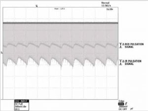 Figure 2: Real-time Red and Infrared (IR) pulsation signals, as captured by an oscilloscope