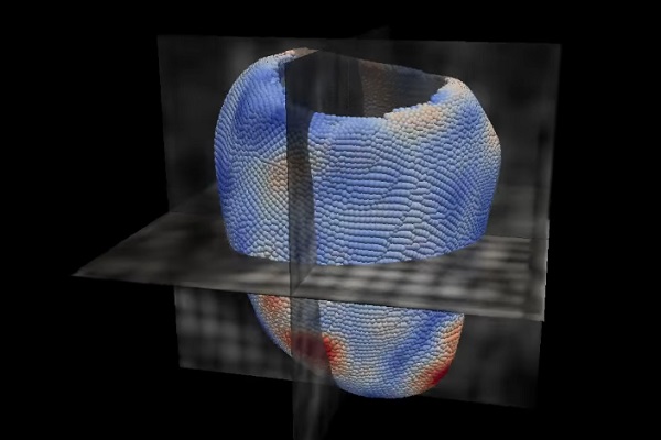 , Artificial intelligence learns to predict heart failure