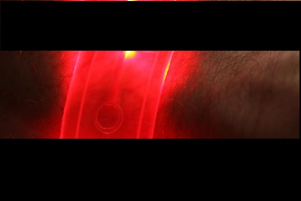 , Flexible electronic devices with roll-to-roll overmolding technology