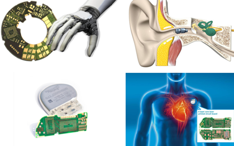 From hearing aids and pacemakers to prostheses Highly miniaturized and