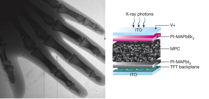 , Samsung Develops X-Ray Detector Material with Low Radiation Exposure